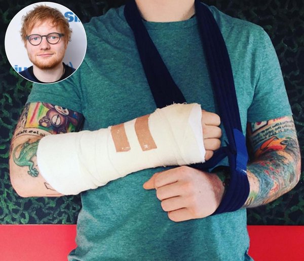 Ed Sheeran bất ngờ gặp tai nạn giao thông khiến fan lo lắng