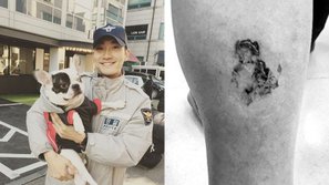 Gia đình người quá cố công bố hình ảnh gây sốc về vết cắn rợn người gây ra bởi chó cưng của Siwon