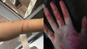 Hỗn chiến tại concert của Wanna One ở Malaysia: Fansite Hàn Quốc và quốc tế lao vào đánh nhau đổ máu, nội bộ fandom bị chia rẽ nghiêm trọng chưa từng có