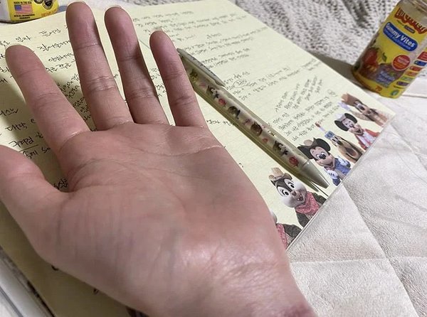 Mina AOA đăng ảnh cổ tay hằn sẹo