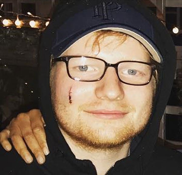  Ed Sheeran rách mặt